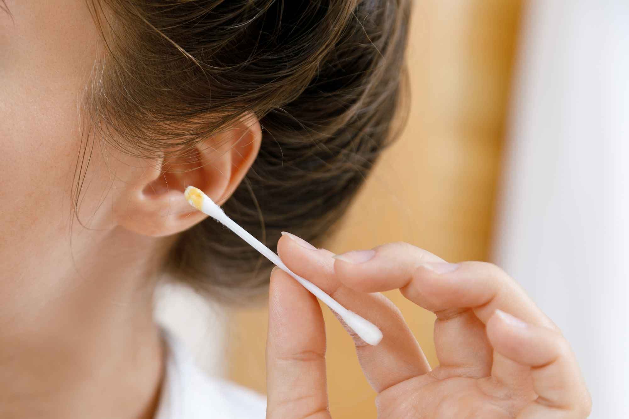 Earwax type