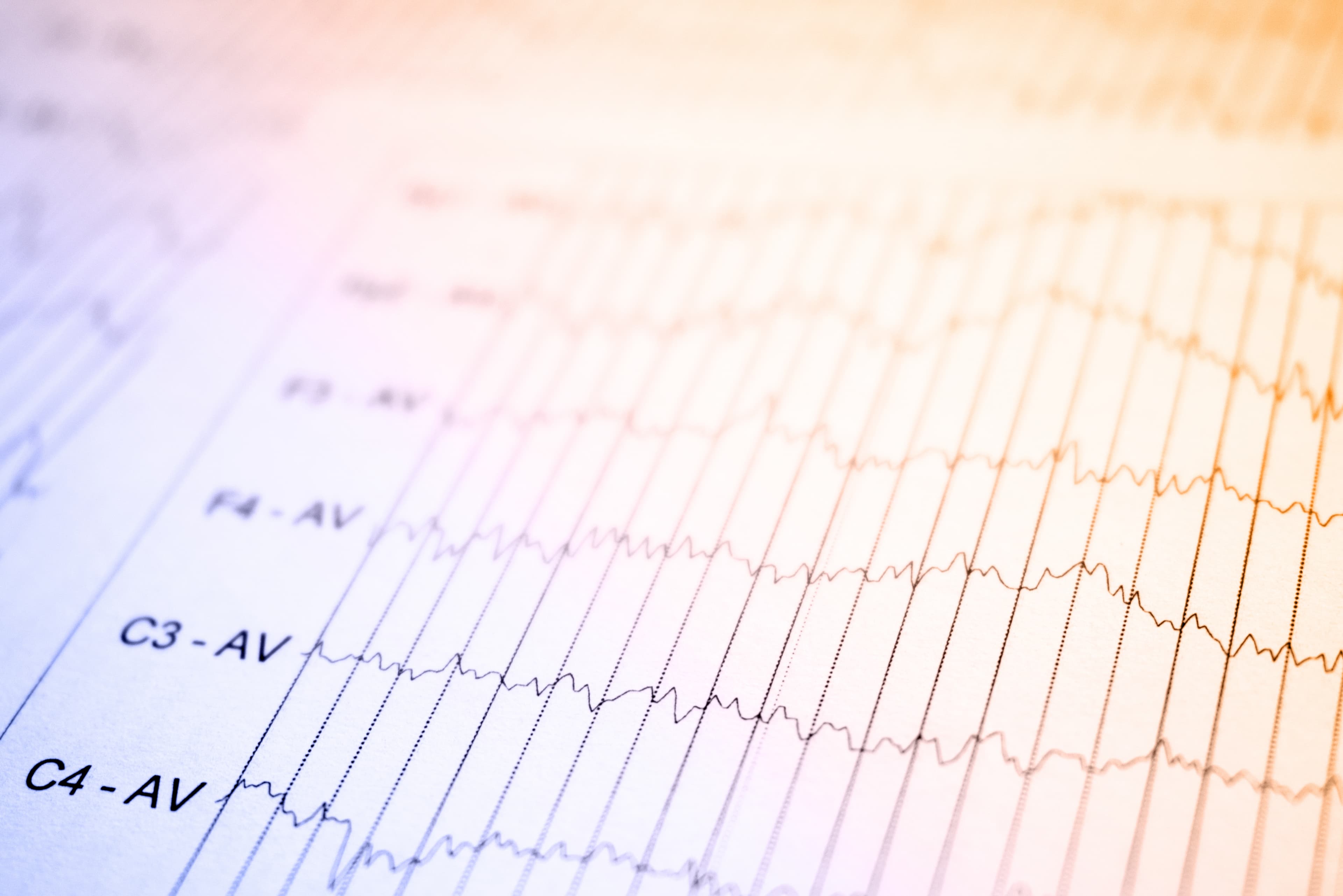 Resting heart rate