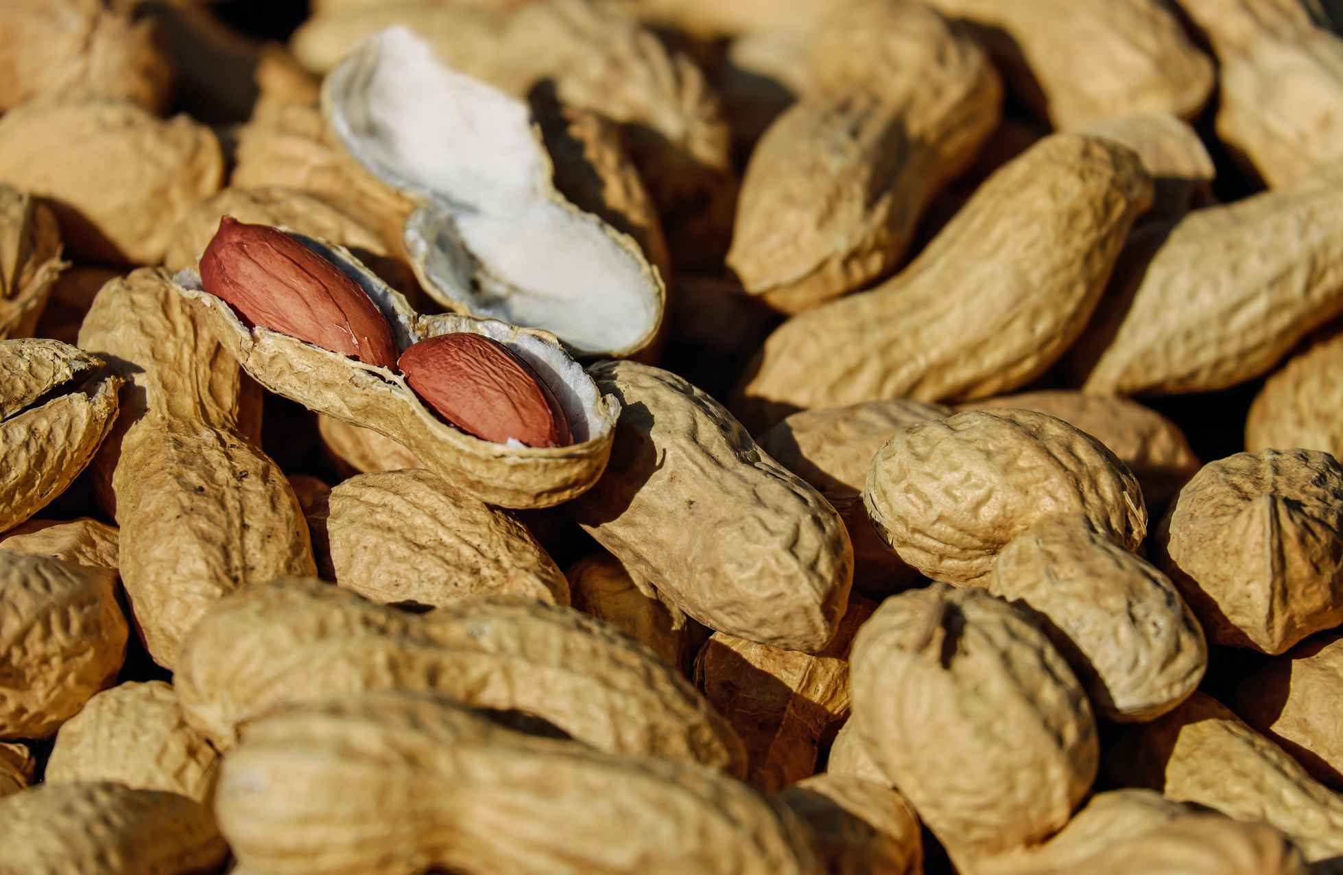 Peanut allergy
