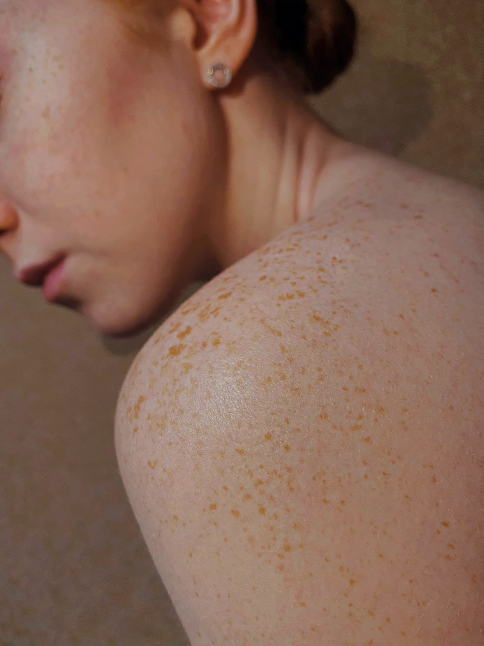 Skin ageing