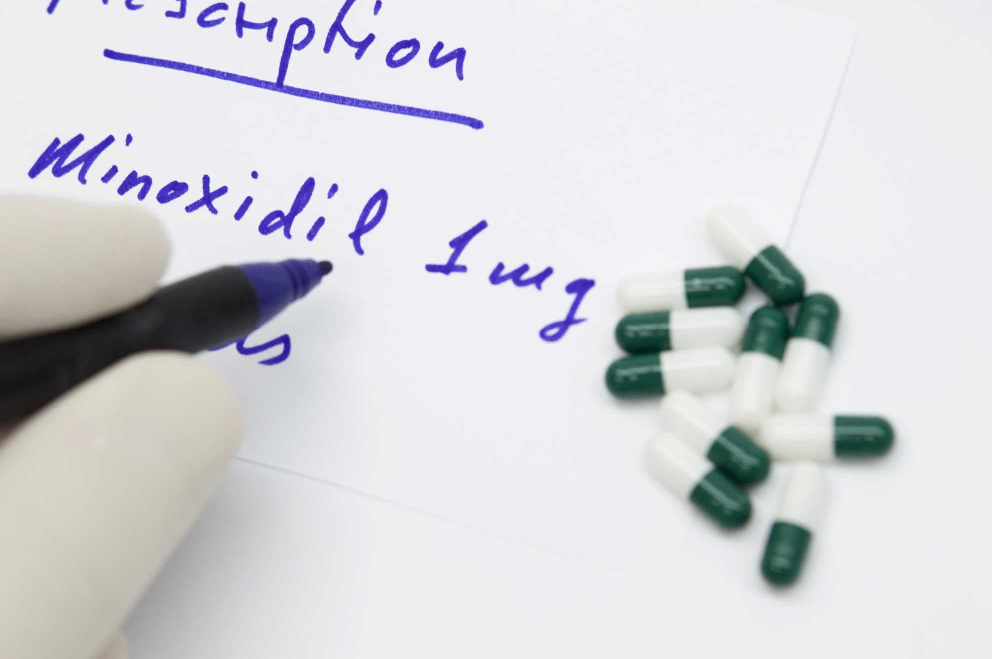 Effect of minoxidil on hair loss